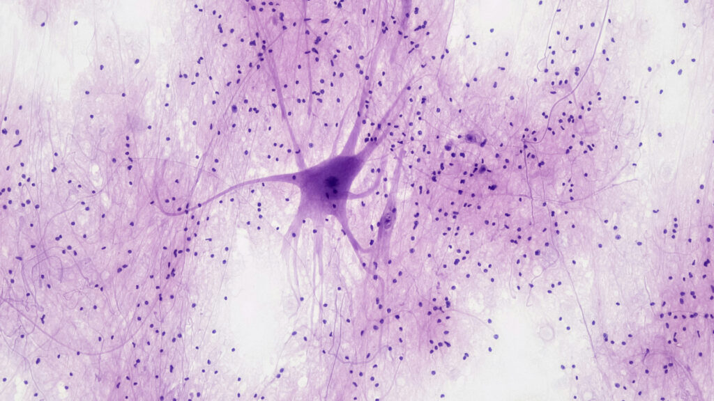 Microbiota, intestino-cerebro y hongos medicinales